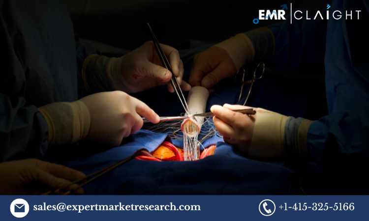 GLOBAL AORTIC VALVE REPLACEMENT DEVICES MARKET SIZE, SHARE