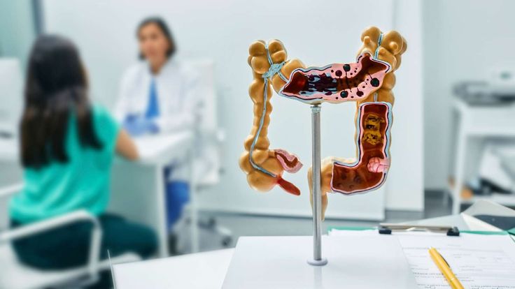 What to Expect from a Visit to a Gastroenterologist