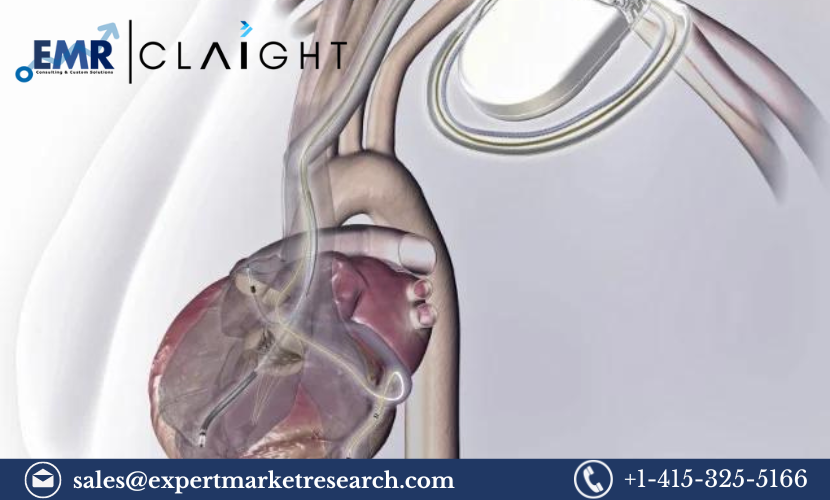 Smart Implantable Pumps Market: A Comprehensive Overview 2032