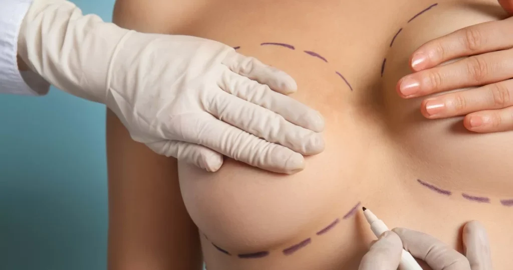 How a Breast Lift Can Improve Your Confidence