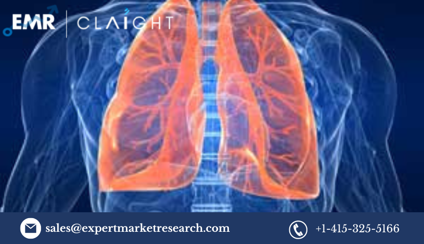 In-Depth Analysis of the Acute Lung Injury Treatment Market: Trends and Future Prospects (2024-2032)