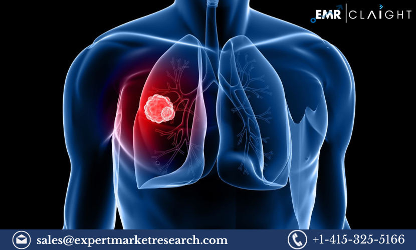 Lung Cancer Screening Market: Trends, Growth, and Key Players (2024-2032)