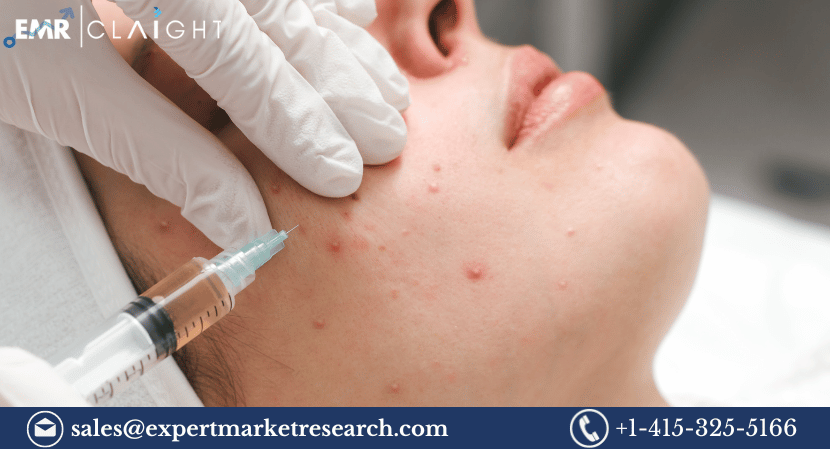 Global Severe Acne Vulgaris Treatment Market Size