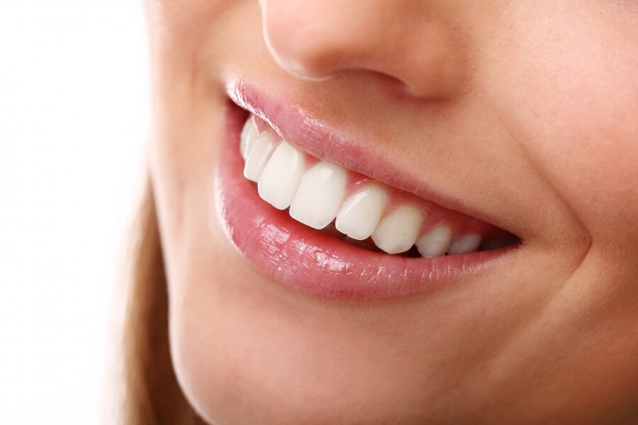 Why is Teeth Whitening at Dentist So Expensive?