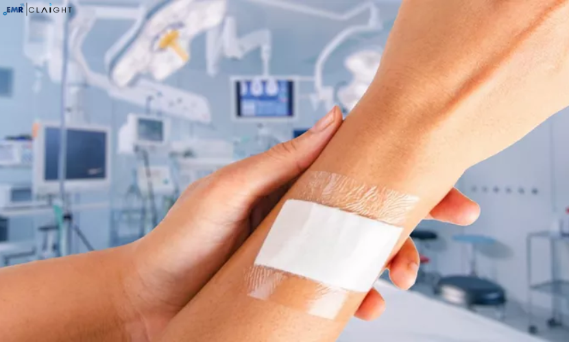 Global Medical Adhesives Market | Share | Size | Trends | Reports | Forecast | Growth | 2024 – 2032