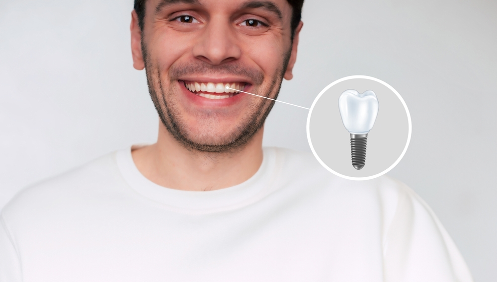 How To Choose Right Dentist For Dental Implants