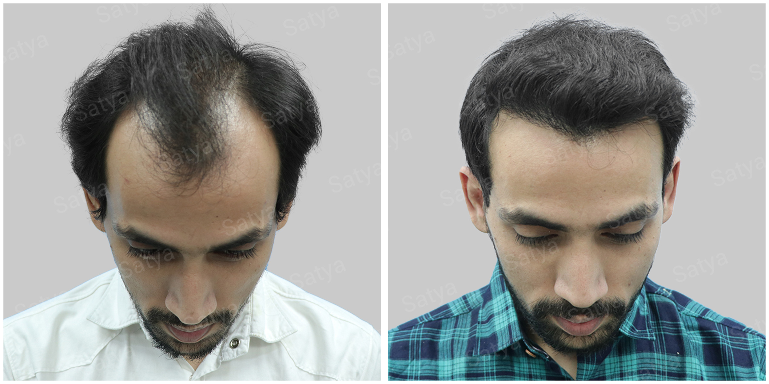 Transform Your Look with Expert Hair Specialists in Gurgaon: