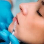 Enhance Your Beauty with Dermal Fillers in Florida |Stellar