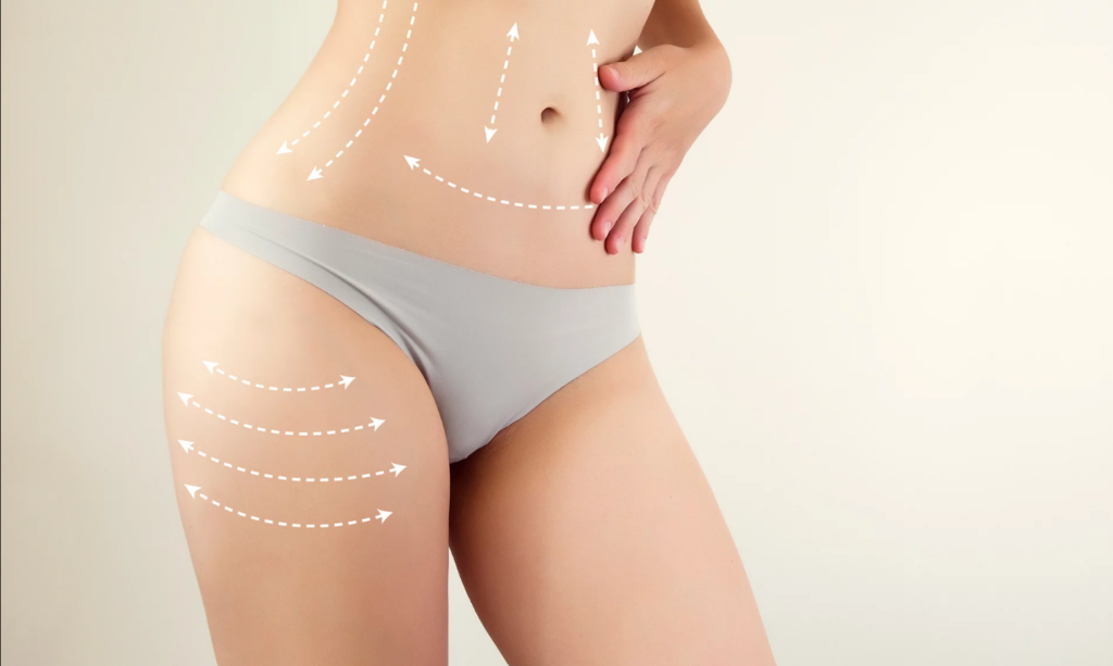 Stomach Liposuction in Dubai How It Can Enhance Your Fitness Journey