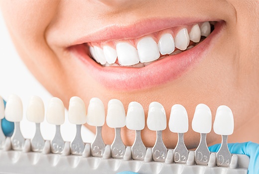 Guide to Cosmetic Dentistry and All-on-4 Dental Implants